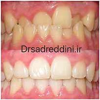 ارتودنسی قبل و بعد