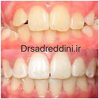 ارتودنسی قبل و بعد