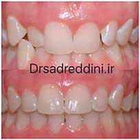 ارتودنسی قبل و بعد