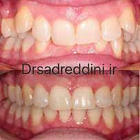 ارتودنسی قبل و بعد