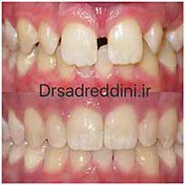 ارتودنسی قبل و بعد