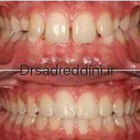 ارتودنسی قبل و بعد