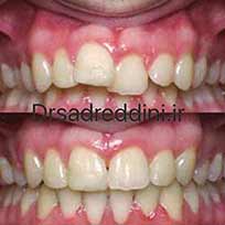 ارتودنسی قبل و بعد