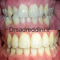 ارتودنسی قبل و بعد