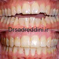 ارتودنسی قبل و بعد