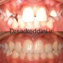 ارتودنسی قبل و بعد