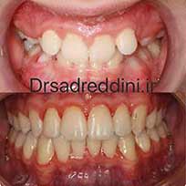 ارتودنسی قبل و بعد