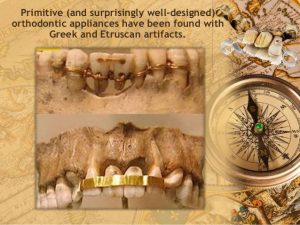 ارتودنسی باستانی | دکتر فرهاد صدرالدینی
