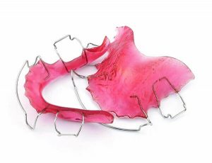 نگهدارنده ارتودنسی متحرک | دکتر فرهاد صدرالدینی