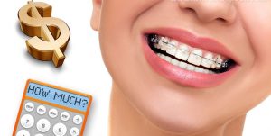 هزینه تقریبی ارتودنسی | دکتر فرهاد صدرالدینی